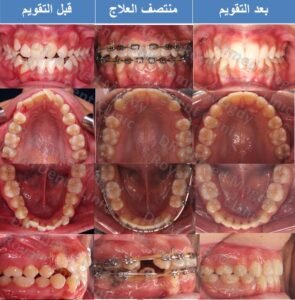 افضل دكتور تقويم اسنان في مصر