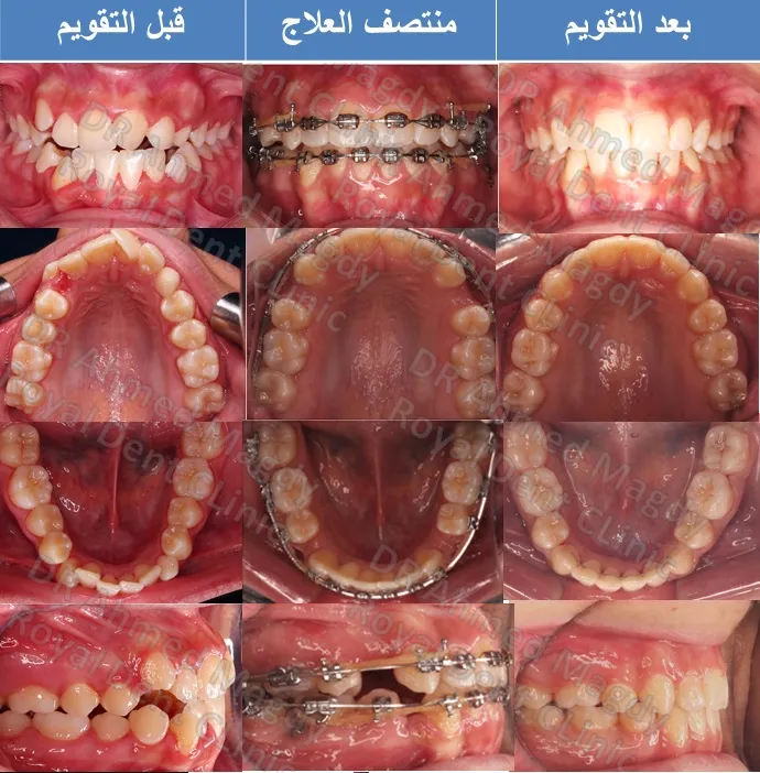 افضل دكتور تقويم اسنان مصر