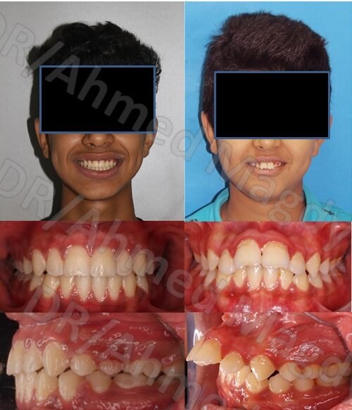 دكتور احمد مجدي- اخصائي تقويم الاسنان